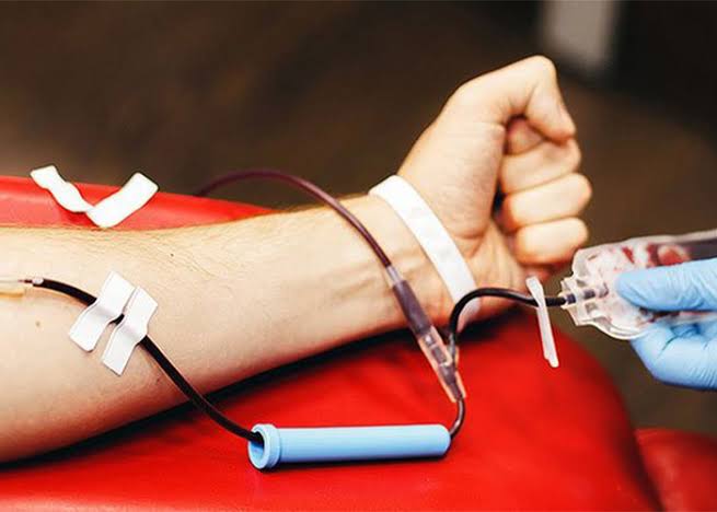 تفاوت فصدخون و حجامت چیست؟ | کدام روش برای شما مناسب است؟ - مطالب تخصصی فصدخون تهران فصد